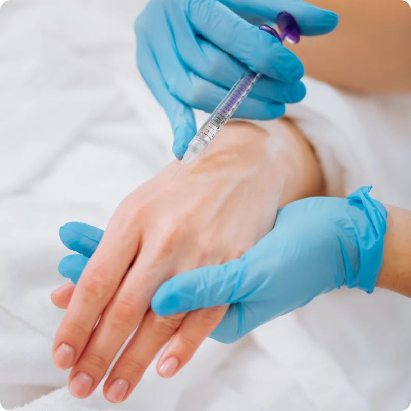 Profhilo hand treatment