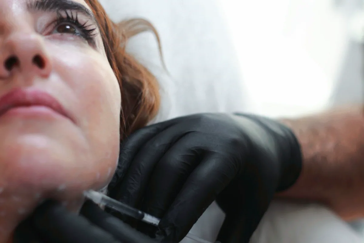 Jawline filler injection performed in a clinical setting