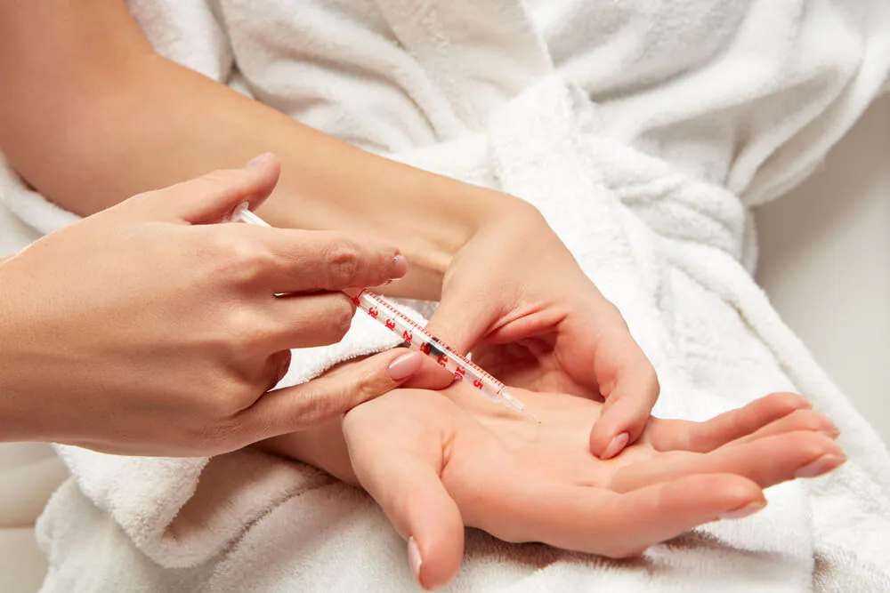 Botulinum-toxin treatment performed in the palm for excessive sweating