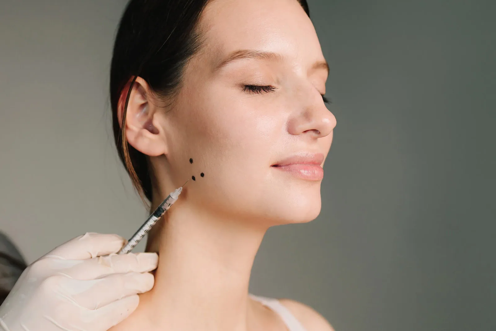 Masseter botulinum-toxin treatment at the angle of the jaw