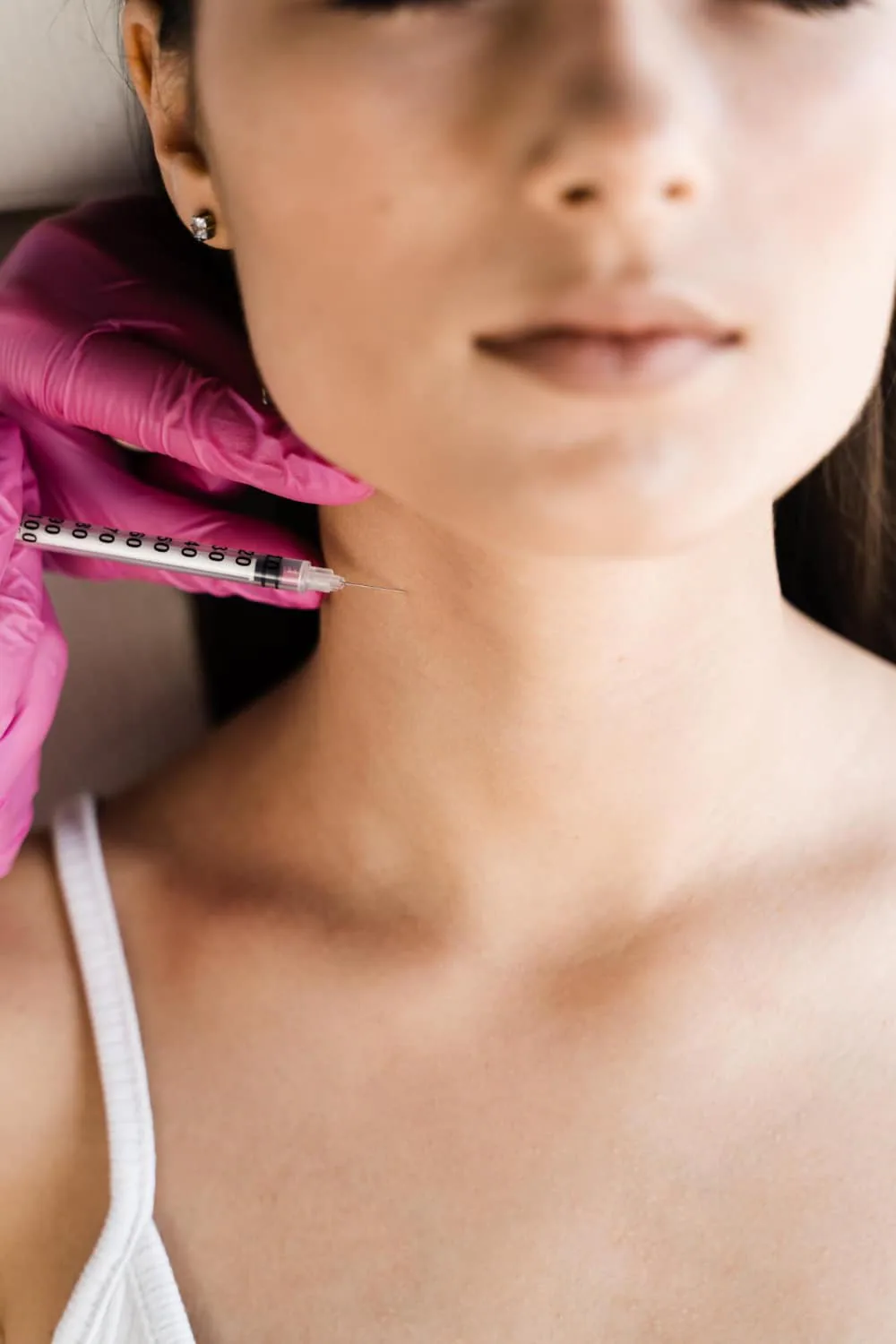 Botulinum-toxin treatment in the side of the neck