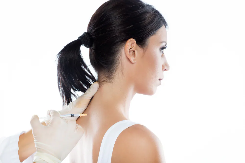 Botulinum-toxin procedure in the upper trapezius area